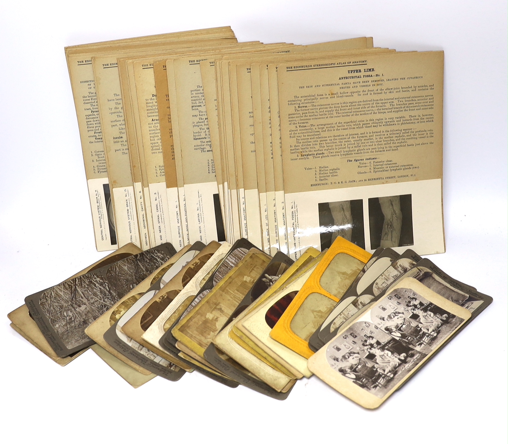 Stereoscopic cards from a set by The Edinburgh Stereoscopic Atlas of Anatomy with detailed information above the photographs, together with a small number of additional cards of different subjects